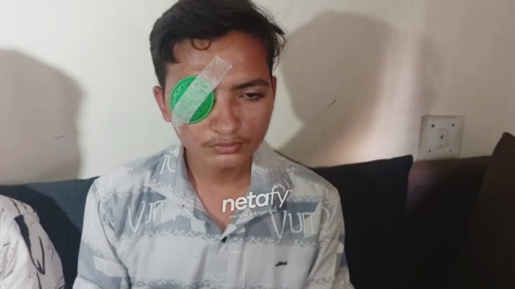 Student met with an serious accident and lost his right eye because cow collided with him - vadodara news - netafy news